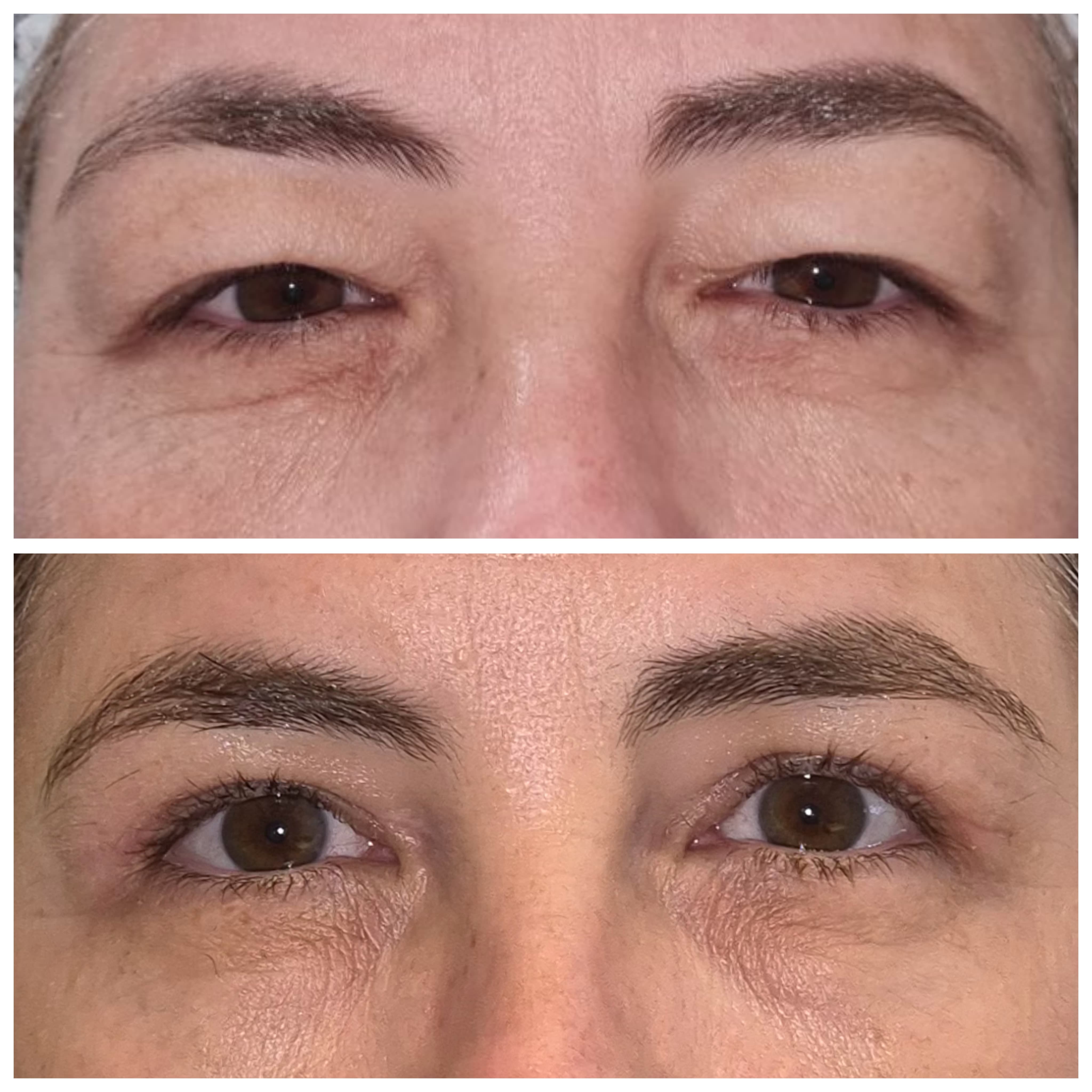 Detalhe de um olhar rejuvenescido